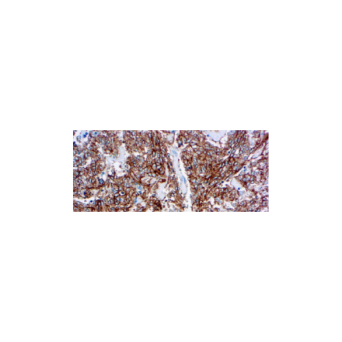 CD117 c-kit