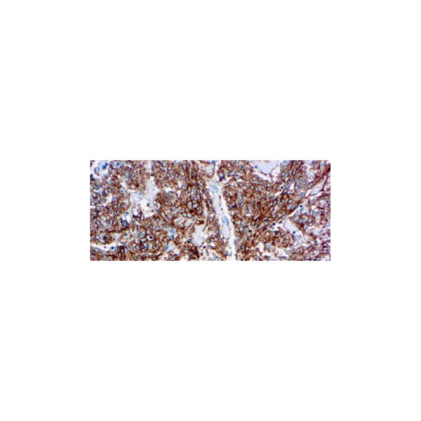 CD117 c-kit