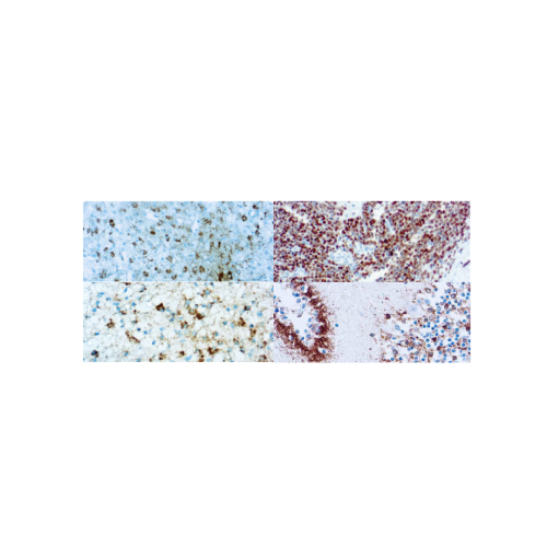 Categoria Neuroendocrino