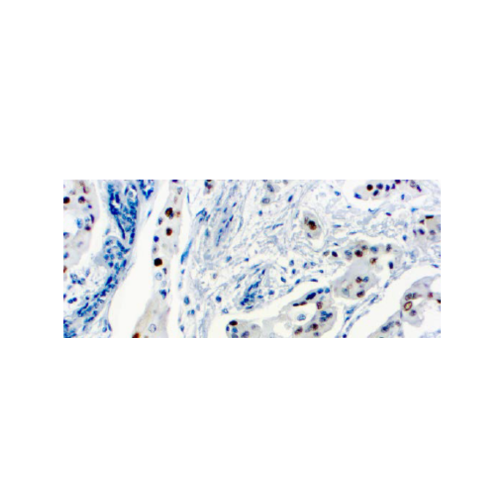 Ciclina D1