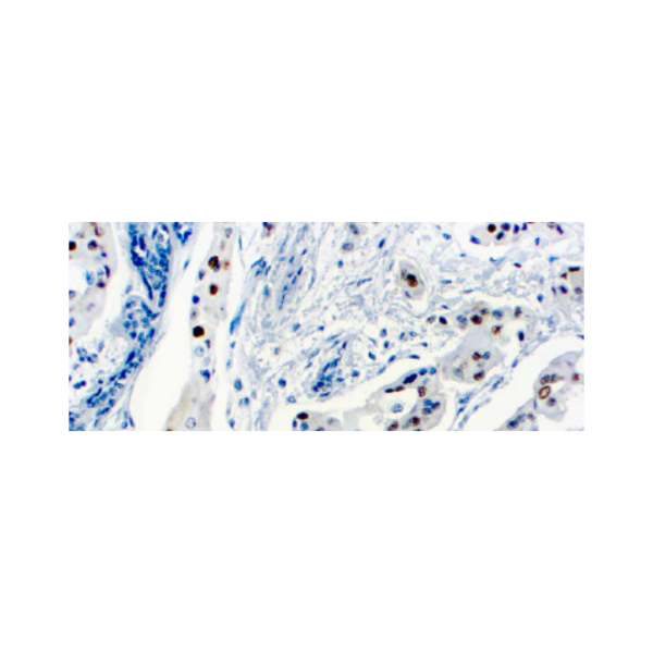Ciclina D1 (SP4)