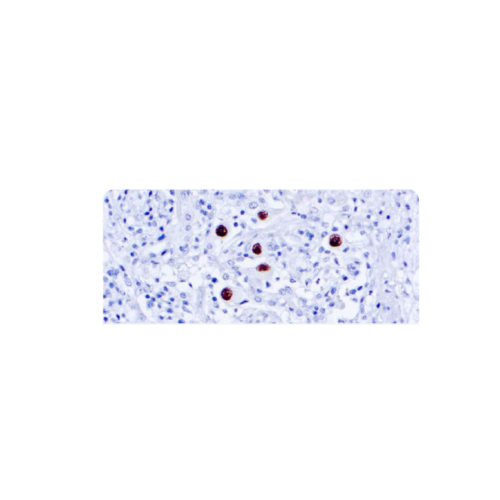 Cytomegalovirus