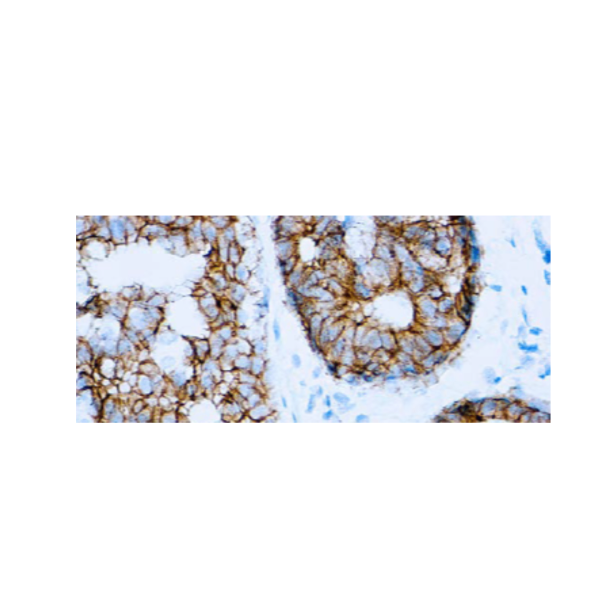 E-Cadherin