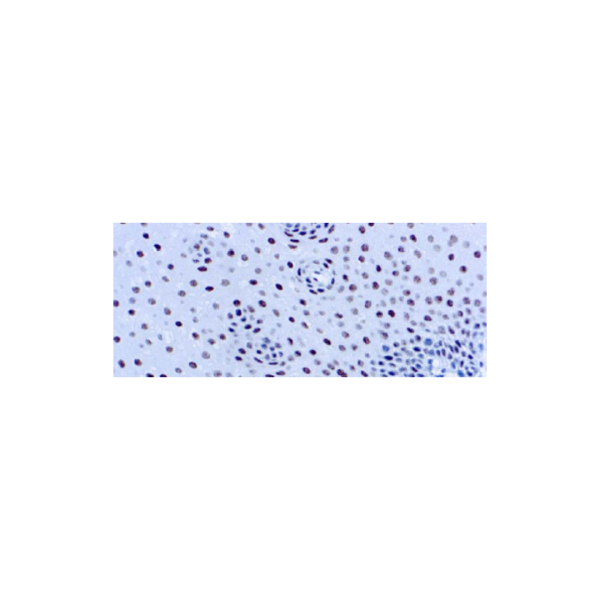 ERCC1