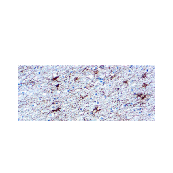 Glial Fibrillary Acidic Protein (GFAP)