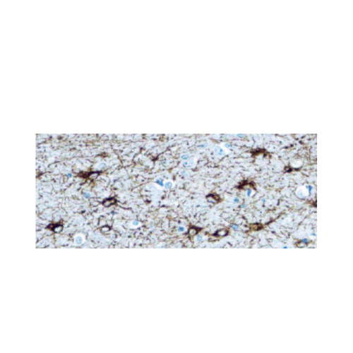 Glial Fibrillary Acidic Protein (GFAP) Anticuerpo monoclonal de Conejo