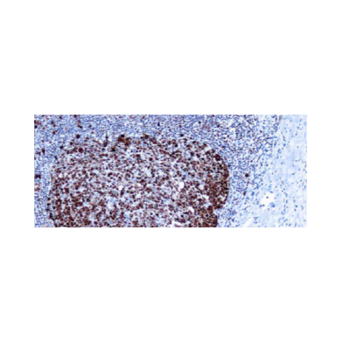 Proliferating Cell Nuclear Antigen (PCNA) (PC10)