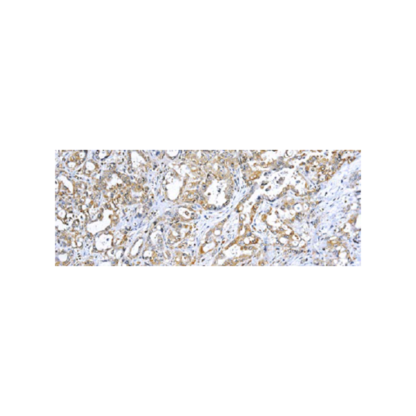 TNF-alpha (Tumor Necrosis Factor alpha)