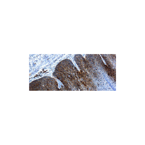 VPH 16