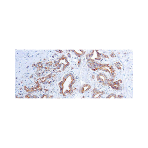 Vascular Endothelial Growth Factor