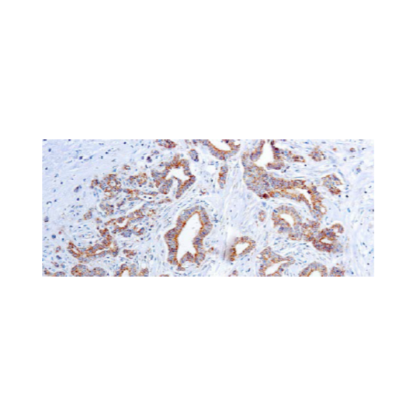 Vascular Endothelial Growth Factor