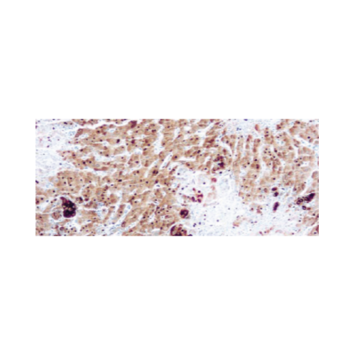 α Fetoprotein (AFP)