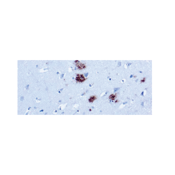 β-Amyloid Protein β-Amyloid Protein