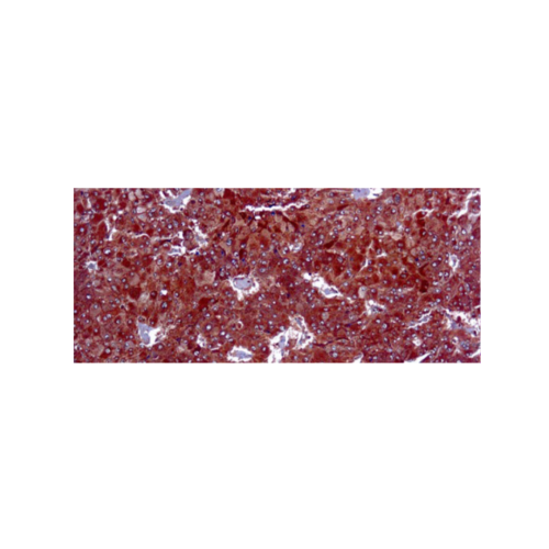 Adipophilin