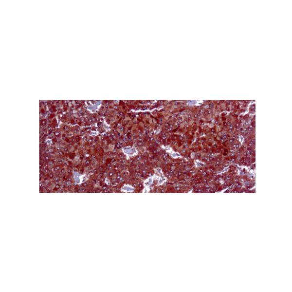 Adipophilin