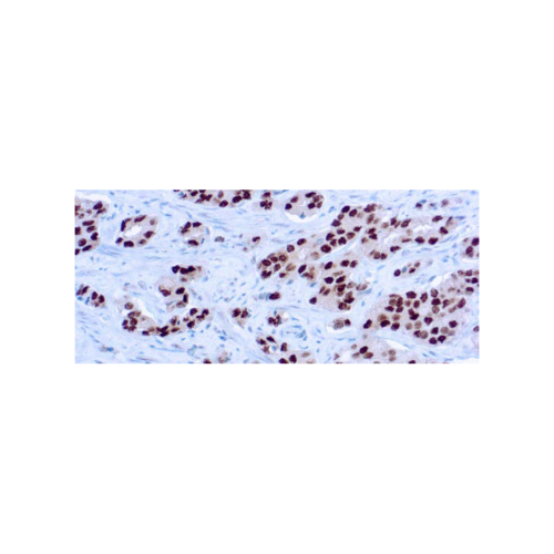 Androgen Receptor