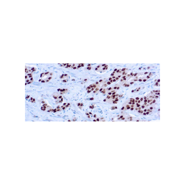 Androgen Receptor