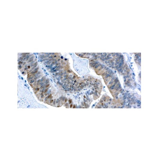 BRCA1