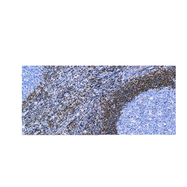 Bcl-2 Onco Proteina