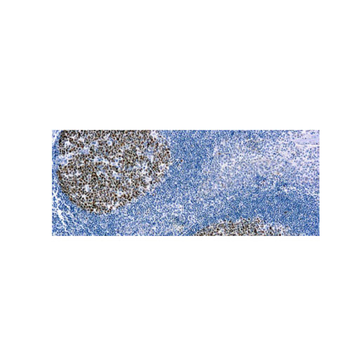 Bcl-6 (PG-B6)