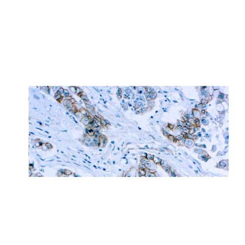 Beta-Catenin