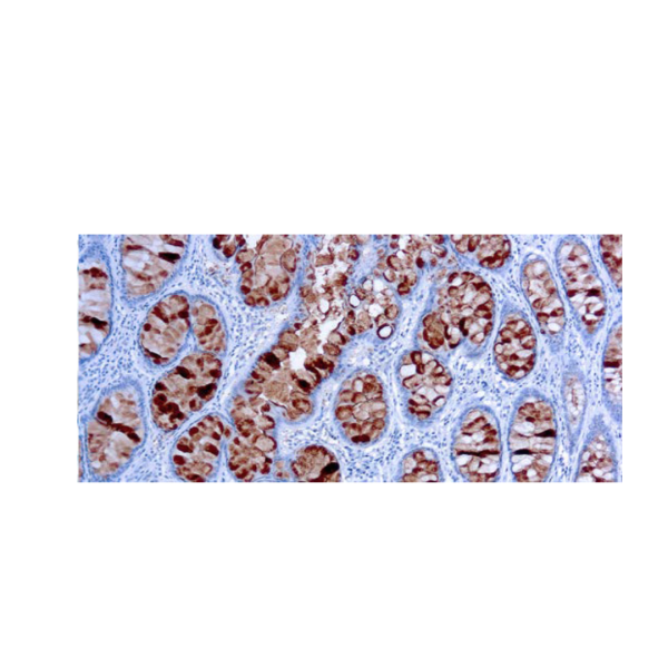CA 19-9