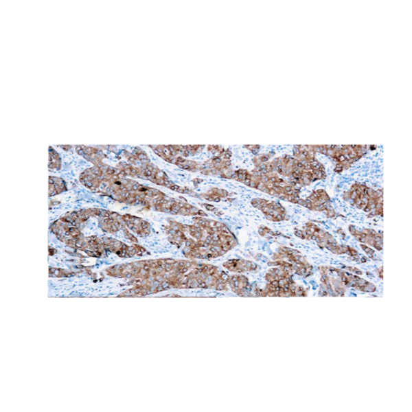 CA15-3