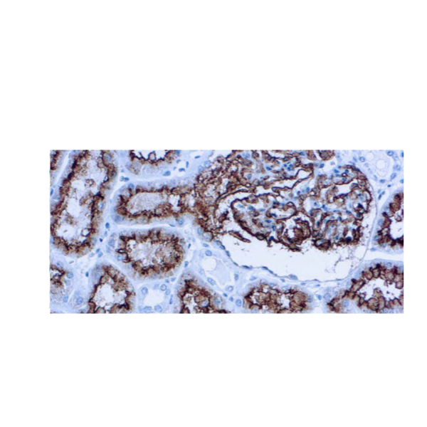 CD10 (CALLA)
