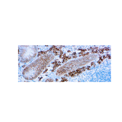 CD138