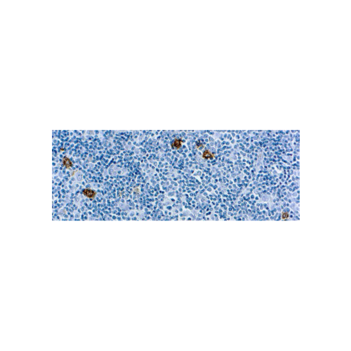 CD15Reed-Sternberg Cell Marker