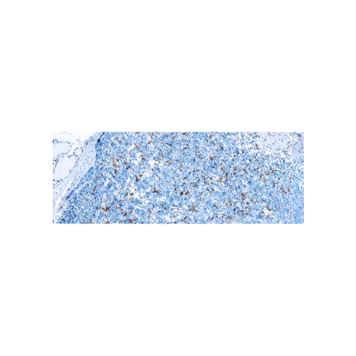 CD163