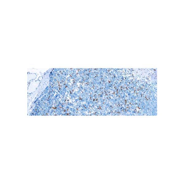 CD163