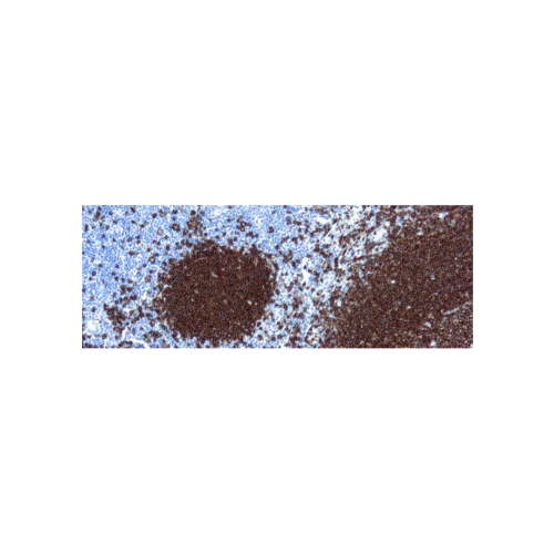 CD20, B-cell (L26)