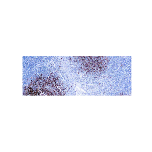 CD23 (SP23)