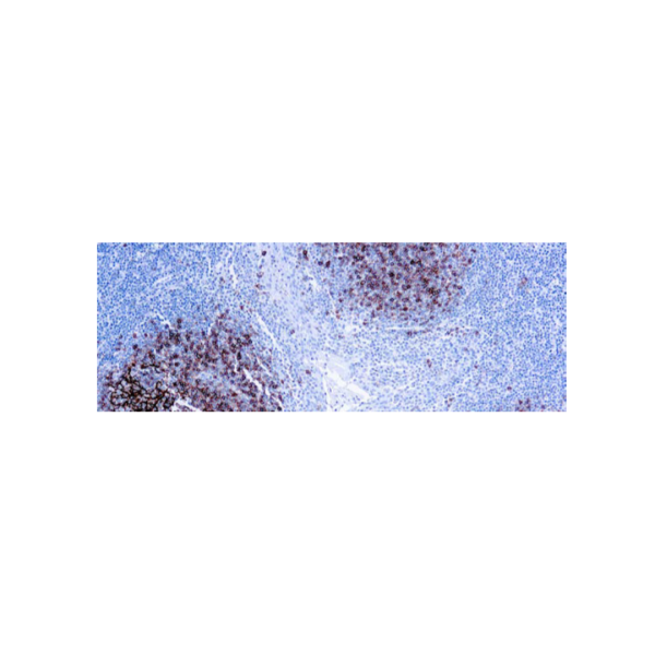 CD23 (SP23)