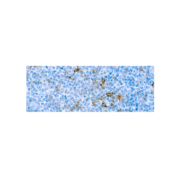 CD25IL‐2R α