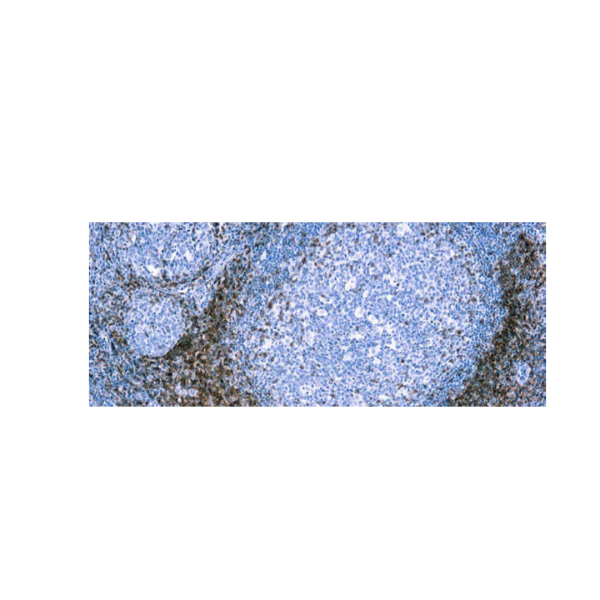 CD5 (CD554F6)