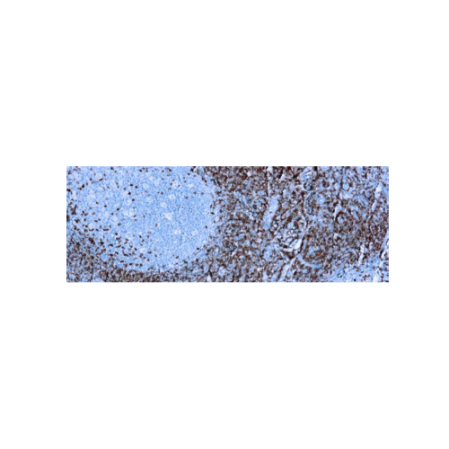 CD5 (SP19)