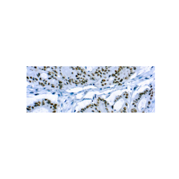 CD56Neural Cell Adhesion Molecule-1