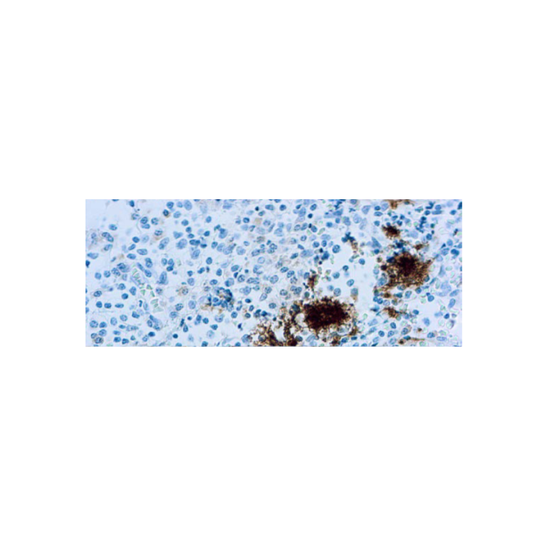 CD61Glycoprotein IIIa plaquetas