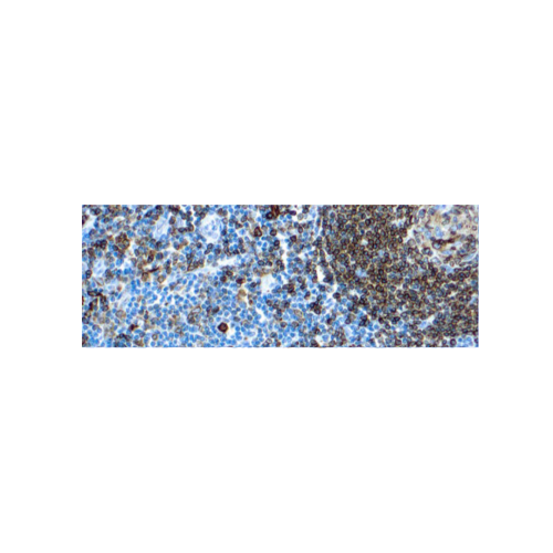 CD74, Marcador de linfoides