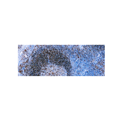 CD79a, B Cell (HM57)