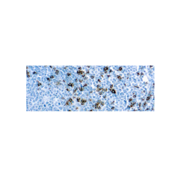 CD8, T Cell