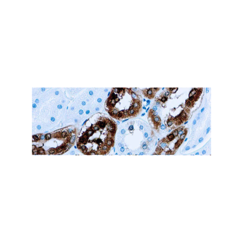 Calbindina-D-28K