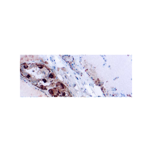 Calcitonina (SP17)