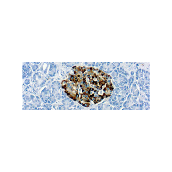 Chromogranin