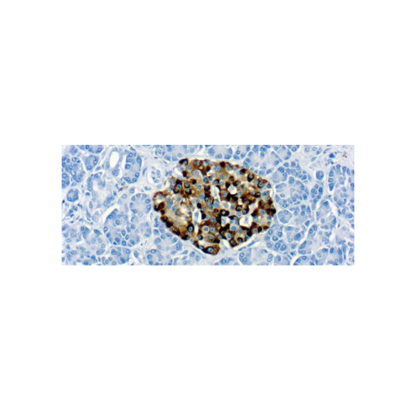 Diagnostic BioSystems 6616 Owens Drive Pleasanton, CA, 94588 Tel: (925) 484 3350 www.dbiosys.com Emergo Europe Prinsessegracht 20 2514 AP, The Hague The Netherlands Tel: (31) (0) 70 345 8570 Chromogranin A (LK2H10)
