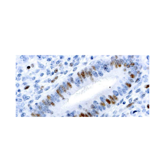 E2F-1 Transcription Factor