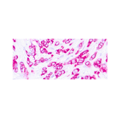 Epithelial Membrane Antigen (EMA) E29