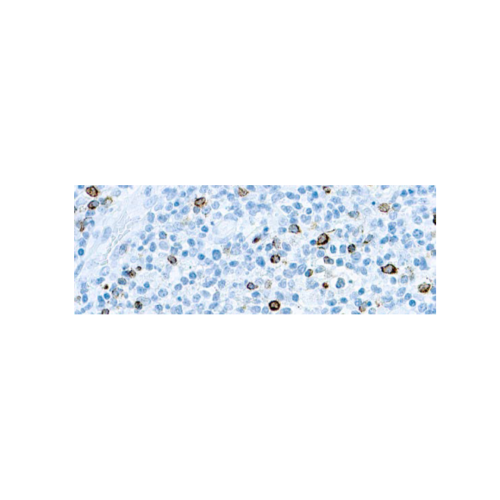 Epstein-Barr Virus (EBV)